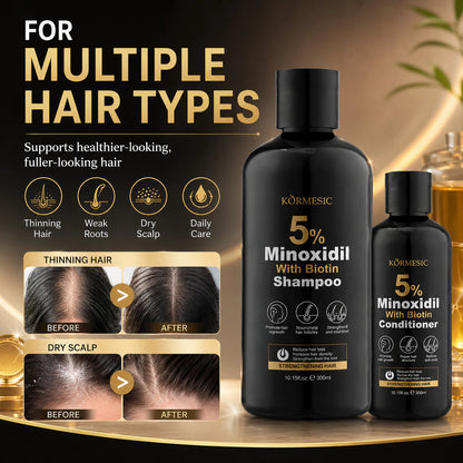 Kormesic - 5% Minoxidil Biotin Shampoo (300ml)